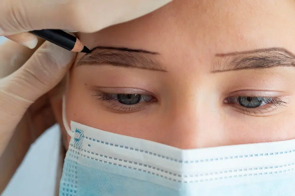 Eyebrow Transplant
