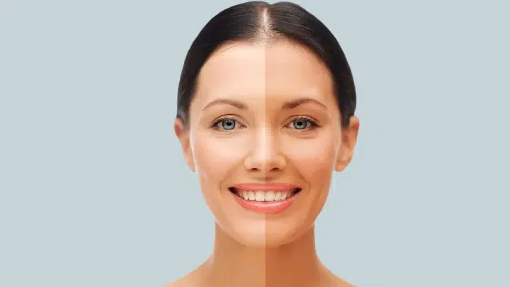 Skin Rejuvenation Injections (Skin Brightening)