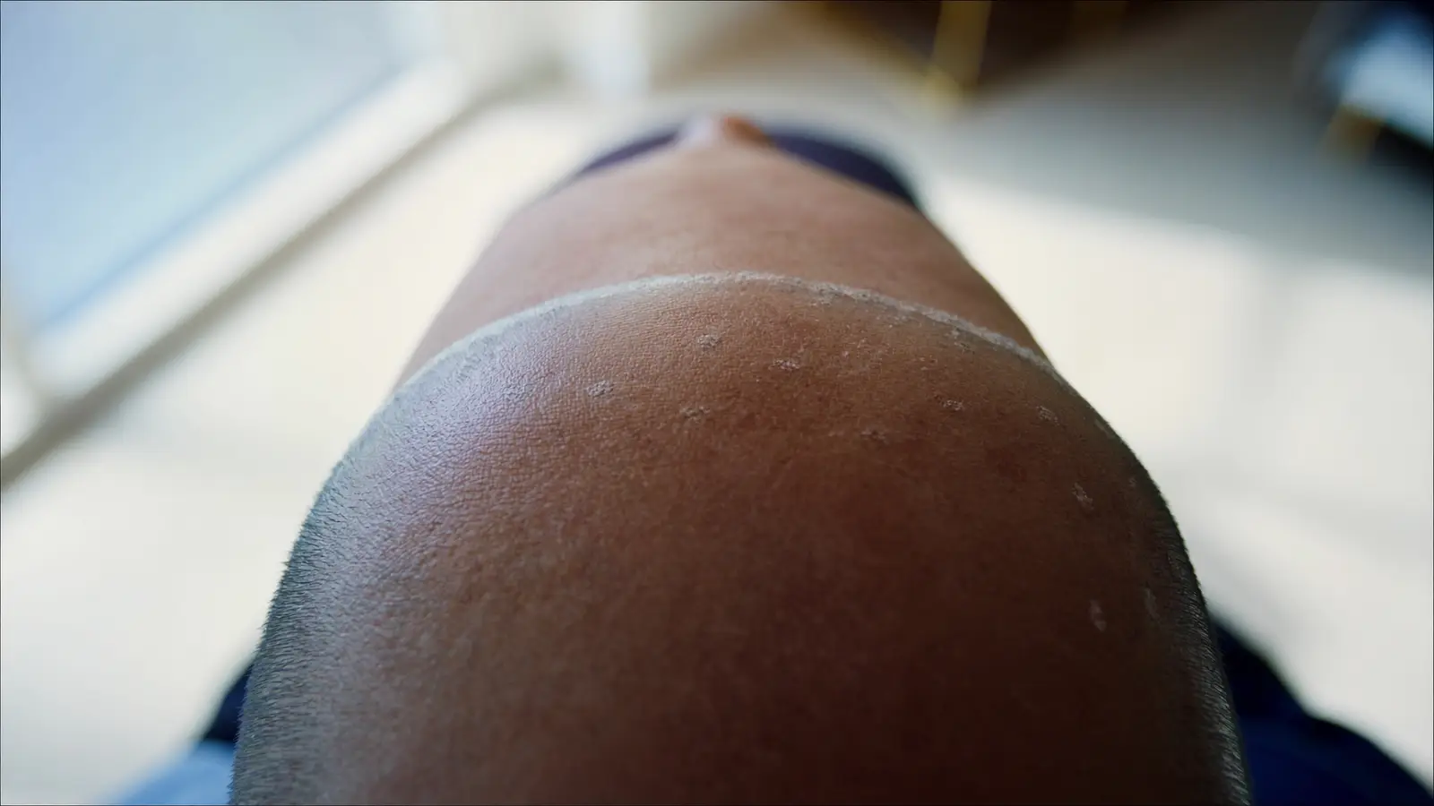 Realistic photographic close-up of a treated scalp showing fine, natural-looking micropigmentation dots that mimic shaved hai